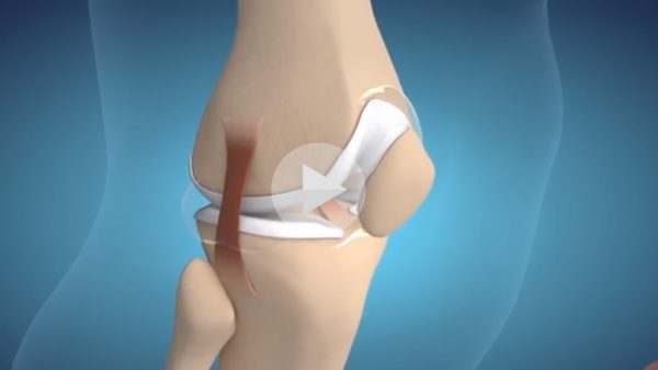 Clip quảng cáo thuốc Evipure