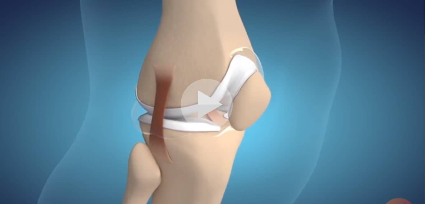 Clip quảng cáo thuốc Evipure